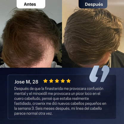 Roll-On de Crecimiento Capilar™